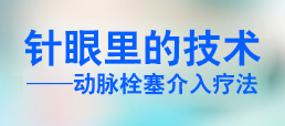动脉栓塞介入疗法