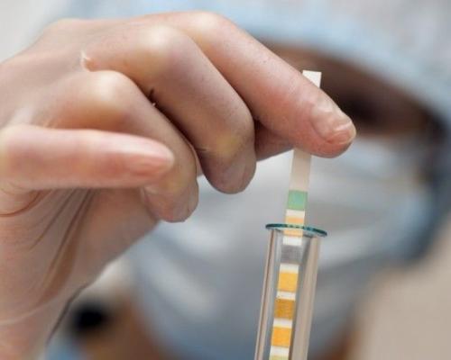 如何测试是否怀孕?怀孕多久能测出来? 早孕试纸