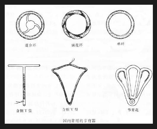 避孕环有哪些好处呢?